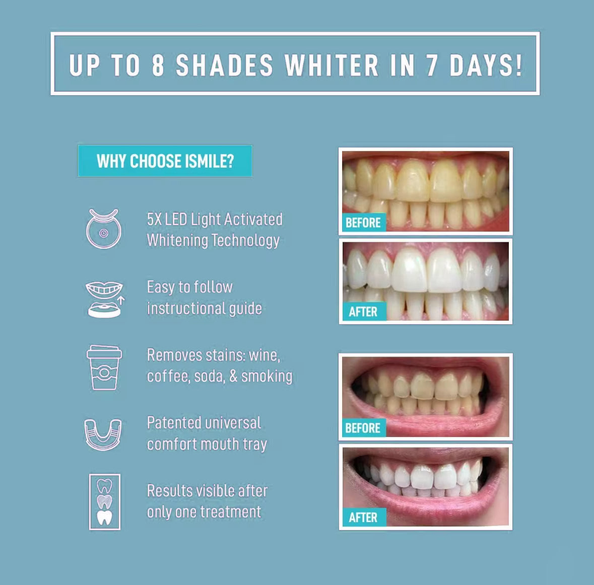 Kit de Blanchiment Dentaire